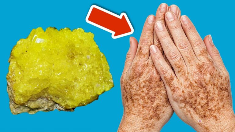 5 sposobów na usunięcie przebarwień dzięki jednemu minerałowi!
